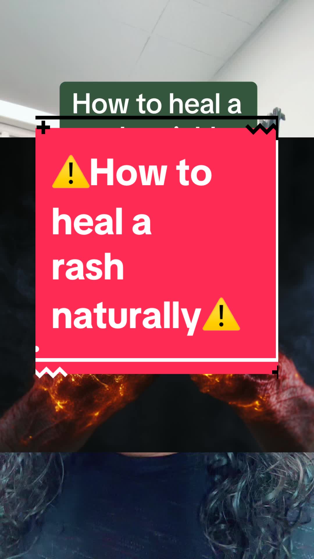 image How to treat skin rashes: home remedies and medical advice